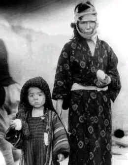 Una donna ed una bambina di Hiroshima