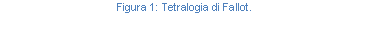 Text Box: Figura 85: Tetralogia di Fallot.