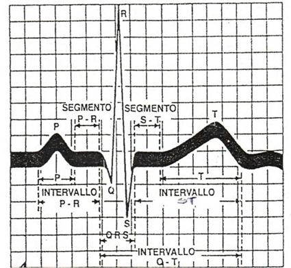 elettrocardiogramma.jpg