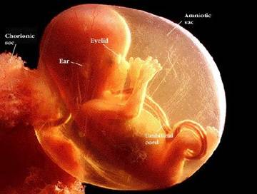 feto alla 14a settimana